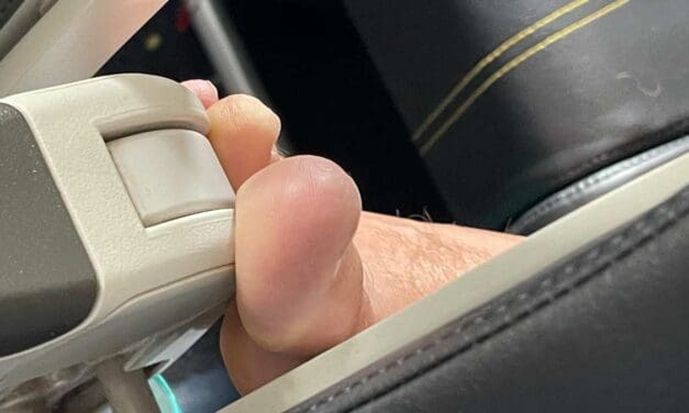 SCOOT: Disgusting passenger — feet on my armrest